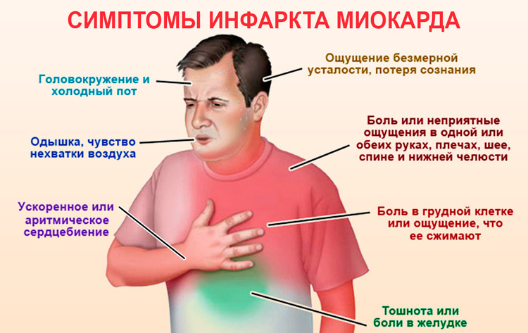 Симптомы инфаркта 2.png